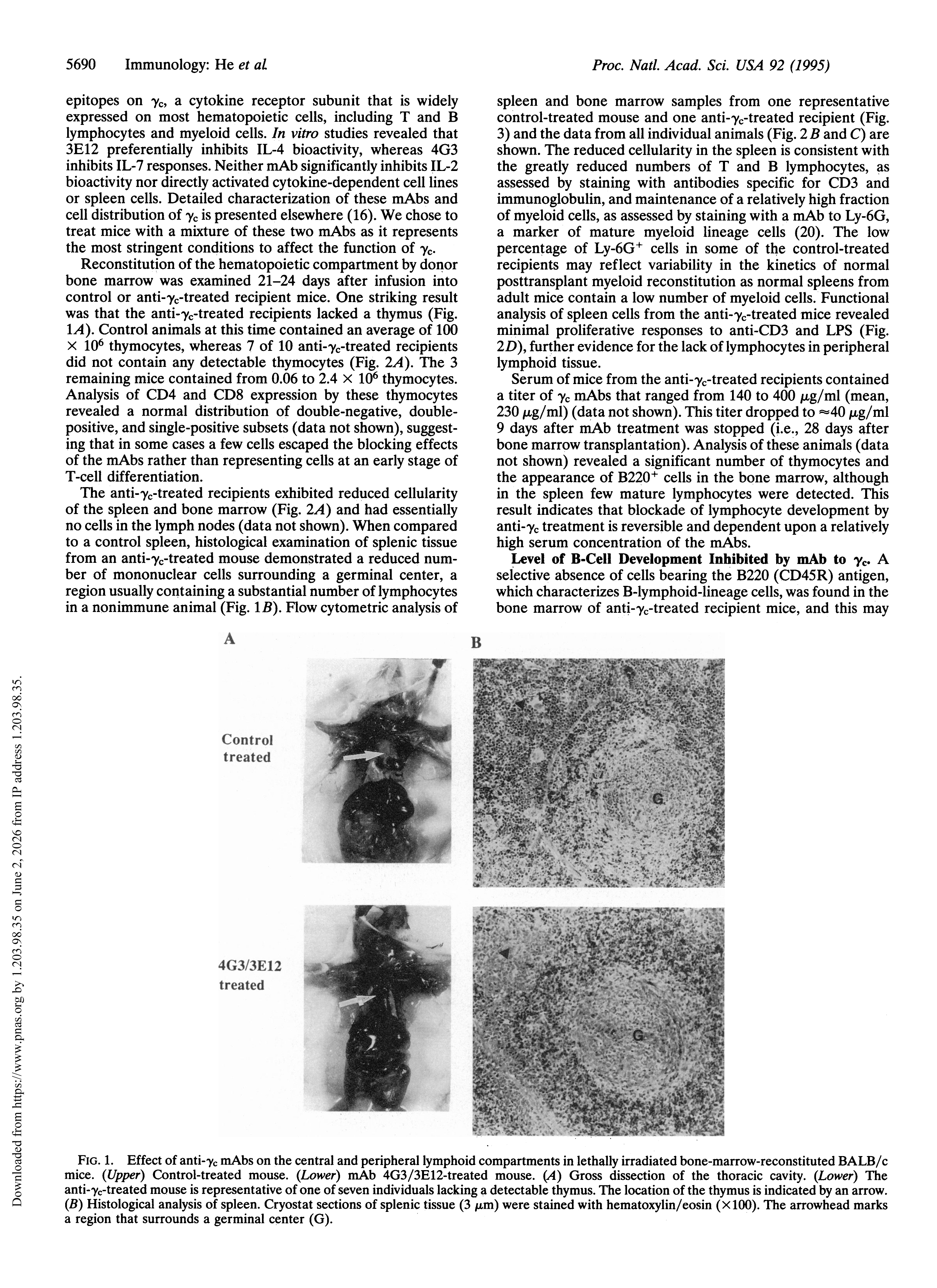 3-Blockade of T- and B-lymphocyte development by antibody to the gamma c subunit of the receptors for interleukins 2, 4, and 7.-2 3-Blockade of T- and B-lymphocyte development by antibody to the gamma c subunit of the receptors for interleukins 2, 4, and 7.-2