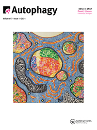 Guidelines for the use and interpretation of assays for monitoring autophagy in higher eukaryotes